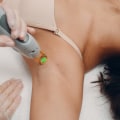 Laser Hair Removal Safety: What Clients Should Understand