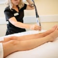 Should i shave before laser hair removal?