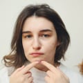 Expert Pimple Treatment and Laser Hair Removal in Hillarys