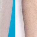 How long after starting laser hair removal do you see results?
