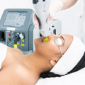 How do i choose a laser hair removal machine?