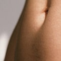 Does hair grow back thicker after laser hair removal?
