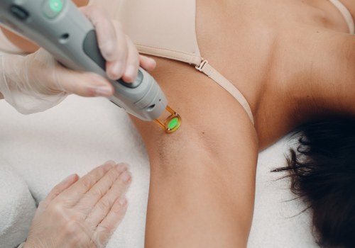 Laser Hair Removal Safety: What Clients Should Understand