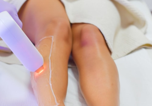 When should i get laser hair removal?