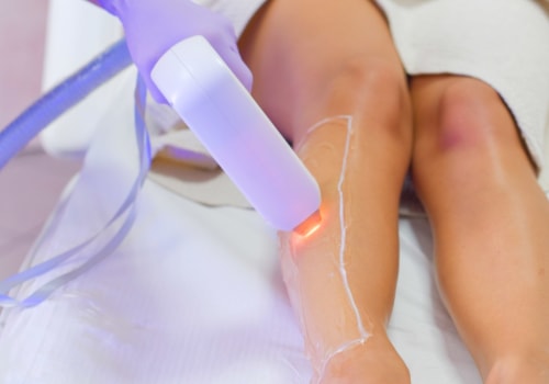 Why you should not do laser hair removal?