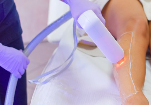 Where not to get laser hair removal?