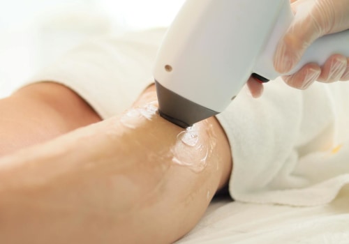 Everything You Need To Know About Laser Hair Removal In Las Vegas
