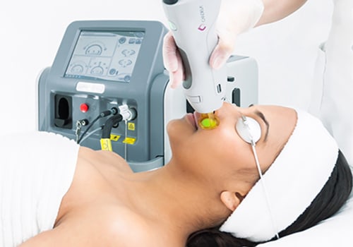 How do i choose a laser hair removal machine?