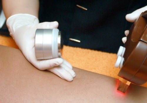 How do you know if your laser hair removal is working?